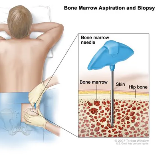 bone marrow examination panel 1